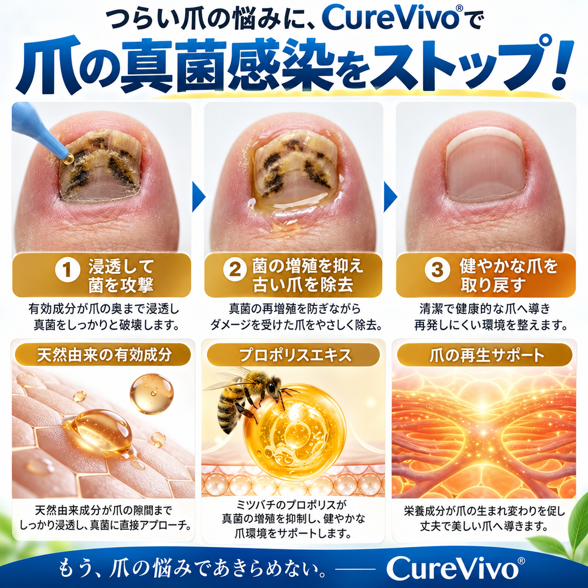 CureVivo® Fungi Free 蜂毒配合ネイルケアセラム