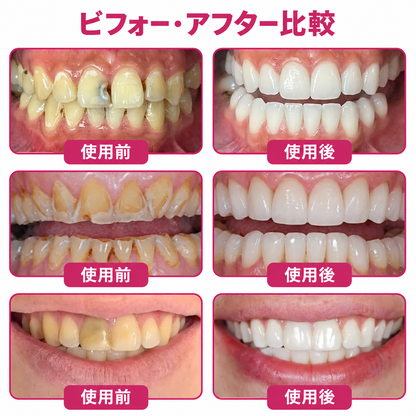 5️⃣𝐇𝐄𝐀𝐓𝐖𝐎𝐋𝐅® 天然エナメル補修 デンタルリペアジェル