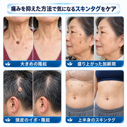 CureVivo® 植物由来成分とスキンケア処方