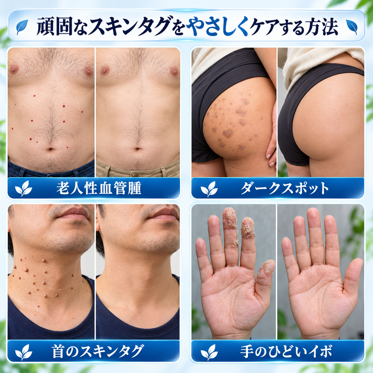 CureVivo® スキンタグケア 使用イメージ